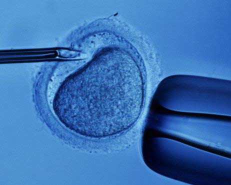 искуственное внедрение сперматозоида в яйцеклетку