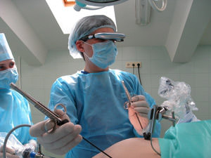удаление кисты яичника - лапароскопическая операция