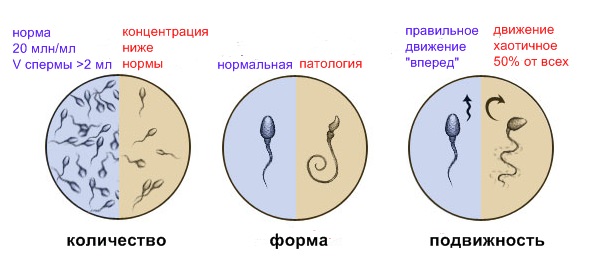 Спермограмма